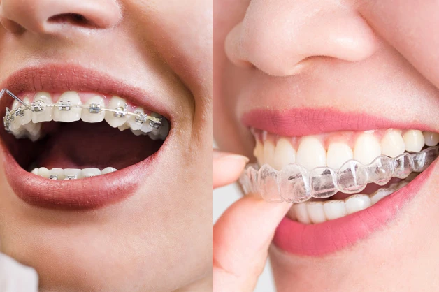 Ortodontia Sicuti Odontologia Dentista Em Sao Vicente Sp
