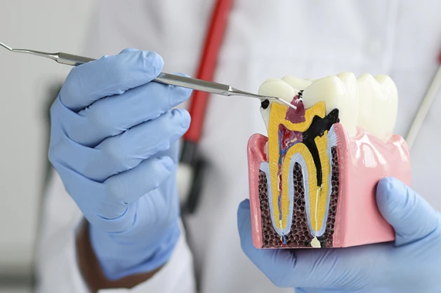 Tratamento De Canal Sicuti Odontologia Dentista Em Sao Vicente Sp