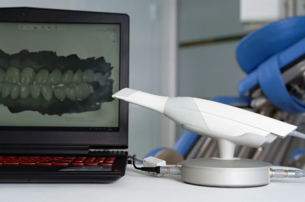 Processo De Escaneamento Digital Dos Dentes Para Confeccao Do Invisalign Processo De Escaneamento Digital Dos Dentes Para Confeccao Do Invisalign