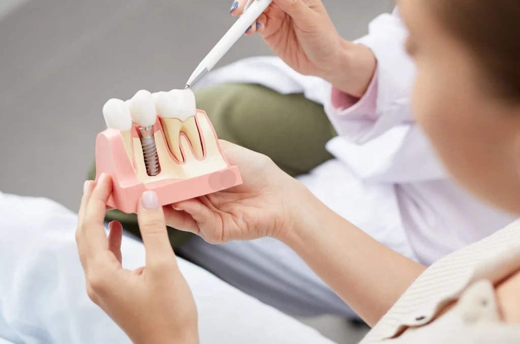 Dentista Explicando Os Beneficios Do Implante Dentario A Um Paciente Apos Extracao Dentista Explicando Os Beneficios Do Implante Dentario A Um Paciente Apos Extracao