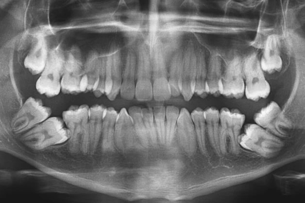 Cirurgia Dental Sicuti Dentista Em Sao Vicente Sp