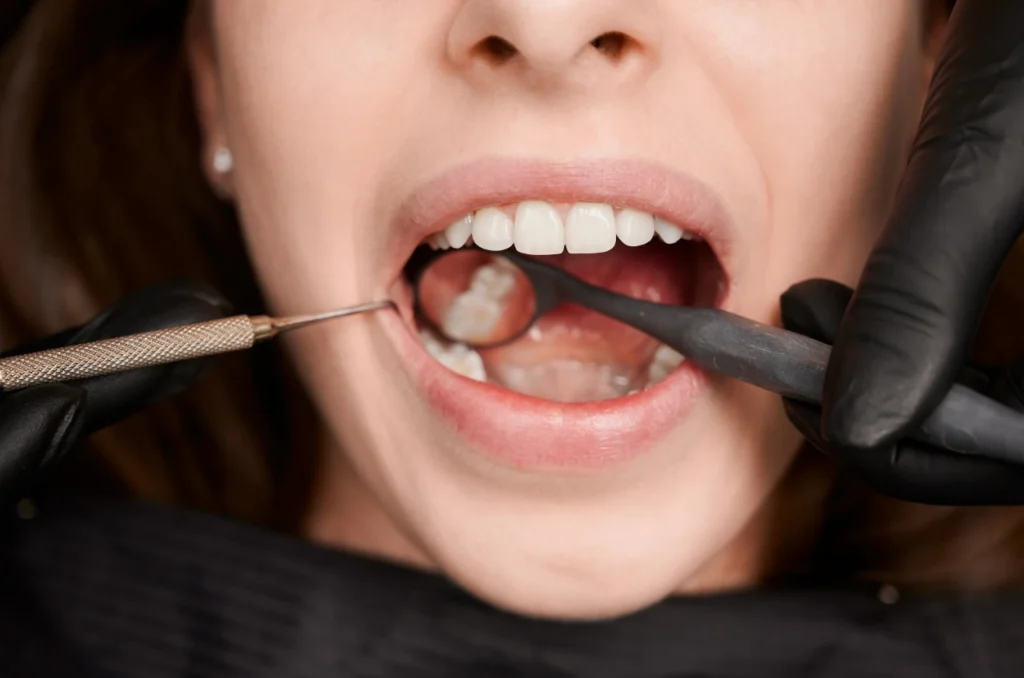 Dentista Revisando O Dente Que Foi Feito Canal