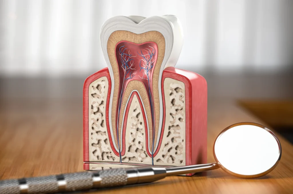 Dente Com Canal Como E Feito