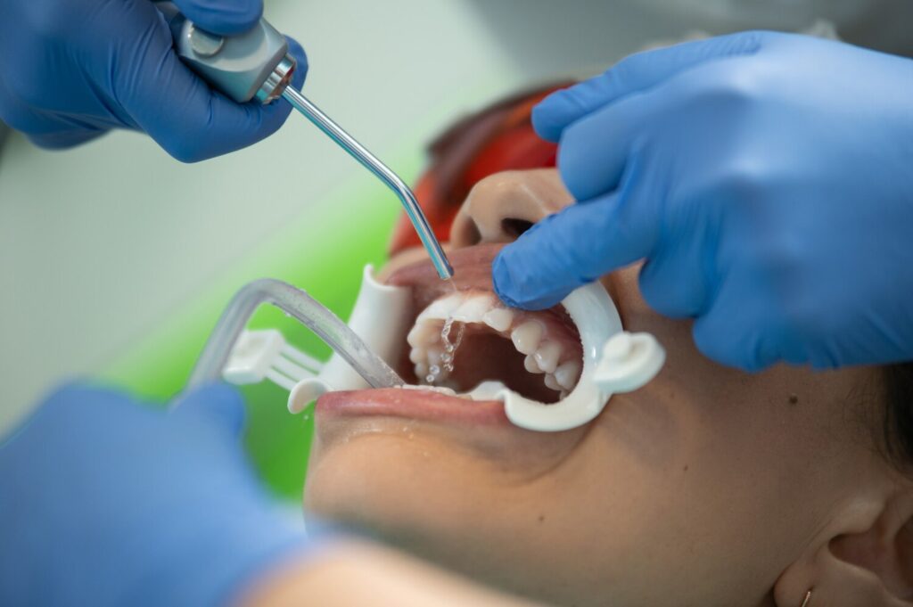 Concept Professional Oral Hygiene Teeth Cleaning Focus Airwater Syringe Salvia Ejection Hands 328764 993
